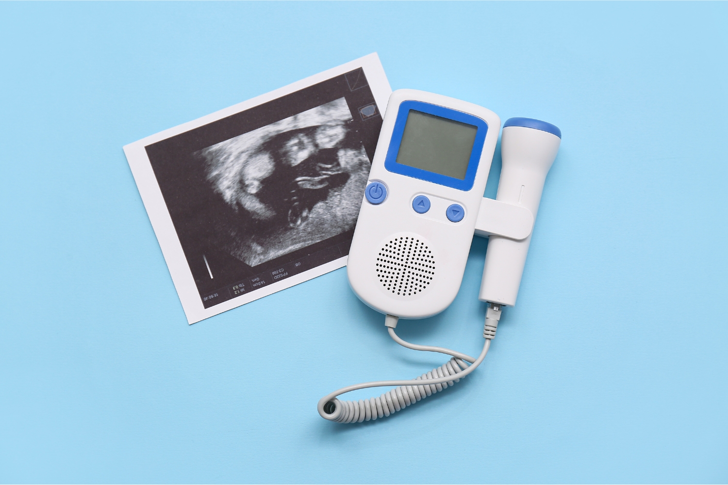 USG Doppler - kiedy warto wykonać badanie i jakie choroby wykrywa